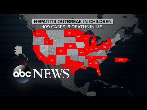 You are currently viewing CDC issues new global alert on hepatitis cases in children | ABCNL