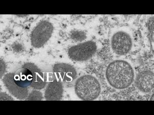 Read more about the article Monkeypox outbreak grows