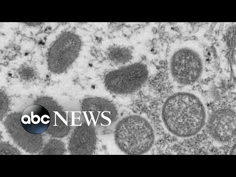 You are currently viewing Monkeypox outbreak grows