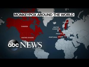 Read more about the article Concerns over monkeypox in the United States
