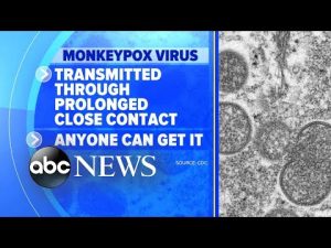 Read more about the article Fears of monkeypox outbreak grow as cases rise l GMA
