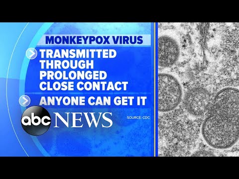 You are currently viewing Fears of monkeypox outbreak grow as cases rise l GMA