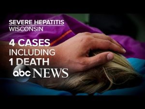 Read more about the article Concerns grow over hepatitis outbreak