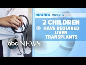 Read more about the article 10 states report increase of severe hepatitis among children l GMA