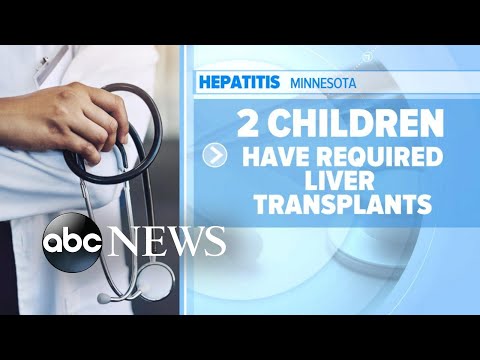 You are currently viewing 10 states report increase of severe hepatitis among children l GMA