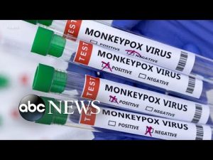Read more about the article Monkeypox cases confirmed in 29 non-endemic countries: CDC