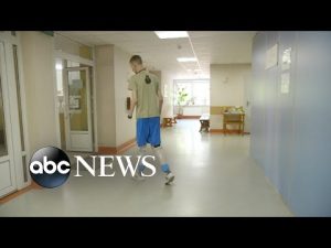 Read more about the article Demand for artificial limbs surges in Ukraine since Russian invasion