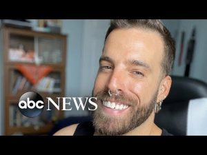 Read more about the article Monkeypox patient shares diagnosis in effort to raise awareness l ABC News
