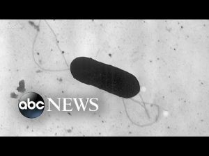 Read more about the article CDC warns of listeria outbreak ahead of holiday weekend