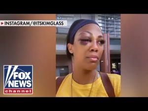 Read more about the article Olympian Kim Glass assaulted by homeless man