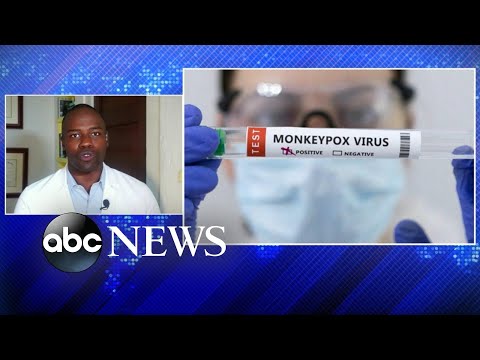 You are currently viewing FDA expands monkeypox vaccine access by dividing doses
