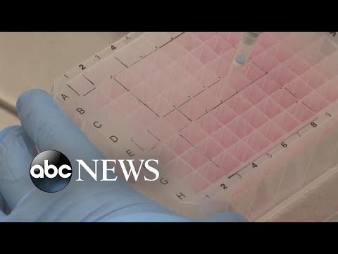 You are currently viewing 3 states declare states of emergency amid monkeypox outbreak in US