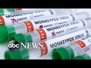 Read more about the article ‘It certainly is a concerning figure’: WHO monkeypox expert on US cases l ABCNL