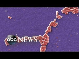Read more about the article At least 11 children across US test positive for monkeypox