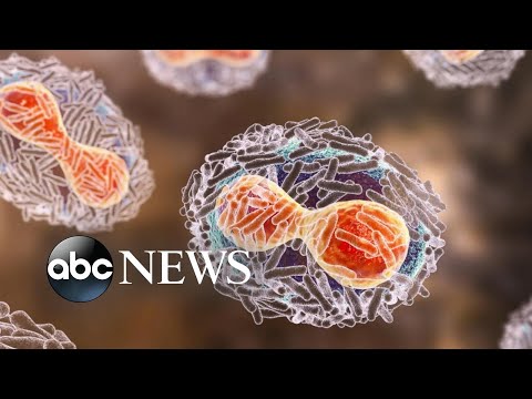 You are currently viewing Dr. Peter Hotez on the spread of monkeypox l ABCNL