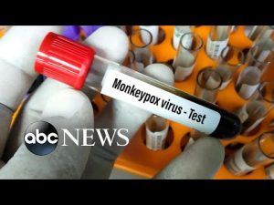 Read more about the article ABC News Live: 5th child in US tests positive for monkeypox