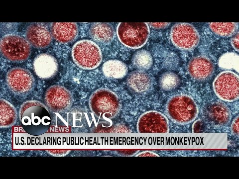 You are currently viewing Biden administration declares monkeypox a public health emergency