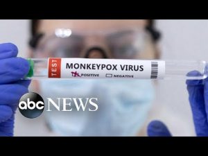 Read more about the article 7 ways to avoid contracting Monkeypox