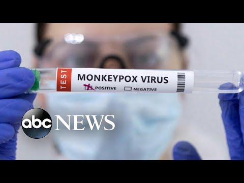 You are currently viewing 7 ways to avoid contracting Monkeypox