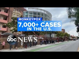 Read more about the article United States reports over 7,000 monkeypox cases