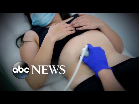 You are currently viewing Prosecuting pregnancy loss: Women advocates fear post-Roe surge | ABCNL