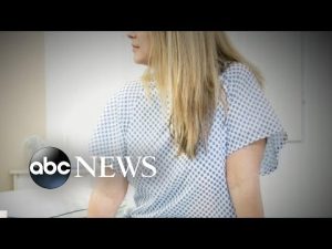 Read more about the article Women and stroke risk