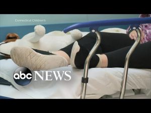 Read more about the article Hospitals swamped with rise in pediatric respiratory cases
