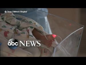 Read more about the article Childhood RSV cases rising, overwhelming pediatric hospital wards l ABCNL