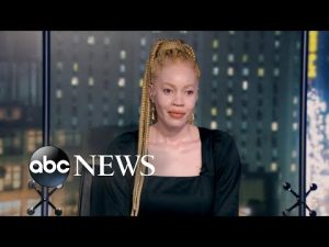 Read more about the article ‘War of Colors’ documents fighting discrimination against albinism | ABCNL