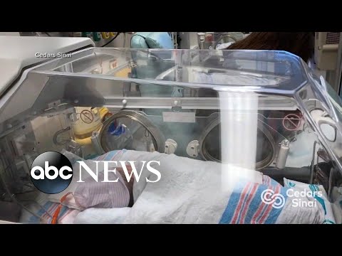 You are currently viewing California county reports ‘unprecedented’ increase in RSV cases