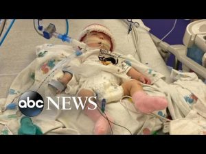Read more about the article Hospitals across the US see increase in patients | WNT
