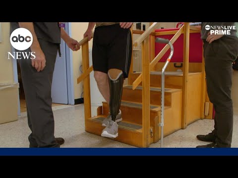 You are currently viewing Good Samaritans outfit Ukrainian soldiers with prosthetics | ABCNL