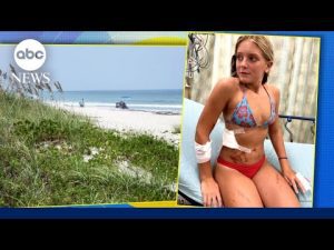Read more about the article 13-year-old fights off shark at beach | GMA