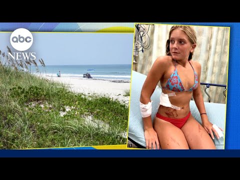 You are currently viewing 13-year-old fights off shark at beach | GMA