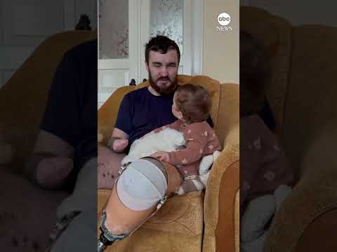 You are currently viewing Blinded, triple-amputee Ukrainian soldier perseveres with love of his wife