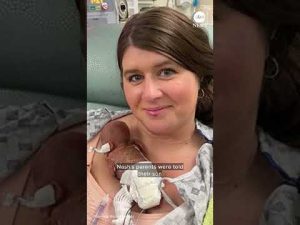 Read more about the article ‘World’s most premature baby’ celebrates 1st birthday