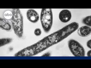 Read more about the article 2 dead and 58 sick from growing Legionnaires’ disease cluster in New York City