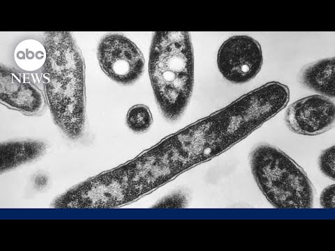 You are currently viewing 2 dead and 58 sick from growing Legionnaires’ disease cluster in New York City