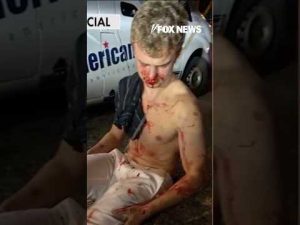Read more about the article ‘BIG BALLS’ BLOODIED: Ex-DOGE staffer brutally attacked in DC #shorts #news #foxnews #crime #us