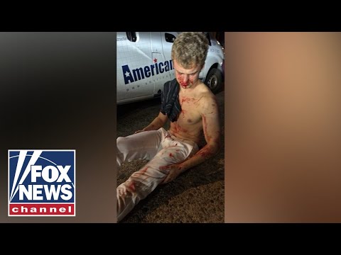 You are currently viewing DETAILS: ‘Big Balls,’ ex-DOGE staffer, brutally attacked in DC