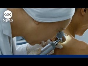 Read more about the article How to protect against melanoma