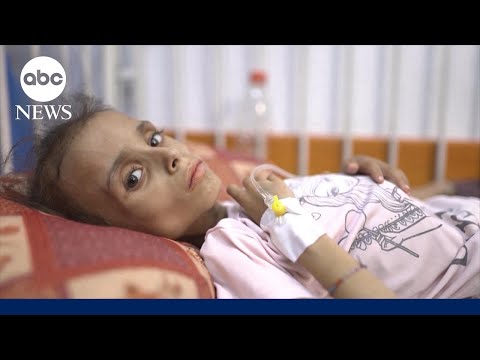 Read more about the article UN officials sound alarm as Gazans continue to starve