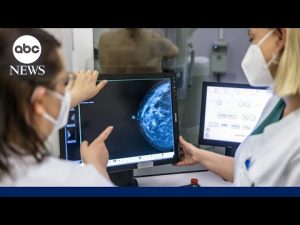Read more about the article Advances being made in detecting and treating breast cancer