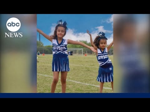 You are currently viewing Conjoined twins needed 12-hour separation surgery — now they’re cheering