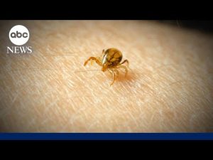 Read more about the article What to know about meat allergies caused by tick bites
