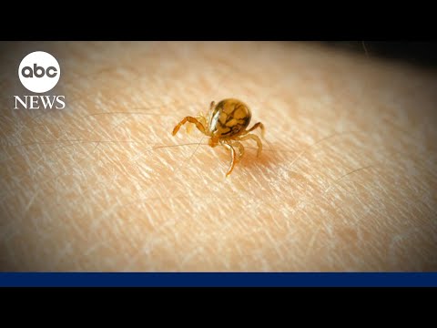 You are currently viewing What to know about meat allergies caused by tick bites