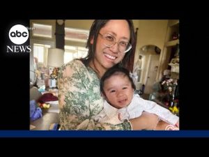 Read more about the article Doctors deliver baby while removing 22-pound tumor from mother