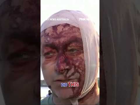 You are currently viewing WATCH: Survivor of Oct 7 narrowly escapes Australia terror attack #foxnews #news #shorts #world