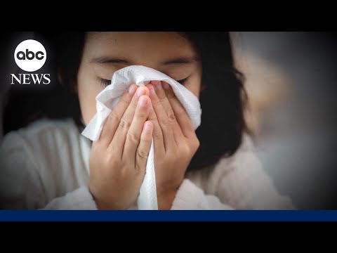 You are currently viewing 15 pediatric flu deaths in 1 week as total reaches 10,000