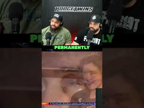 Read more about the article Trans Person Shot In The Eye By ICE With Non-Lethal Round! FAFO!